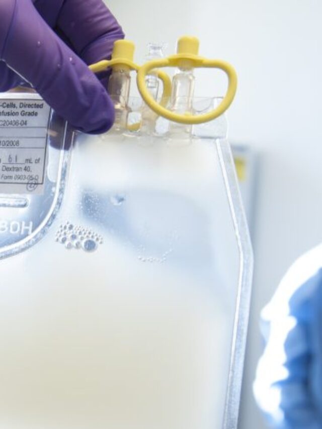 कॉकरोच के खून का रंग कैसा होता है?