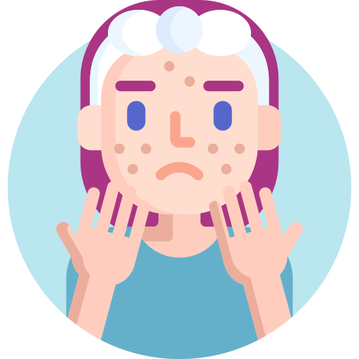 पिंपल के दाग कैसे मिटाएं ?